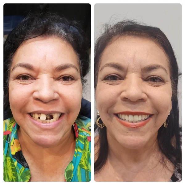 Dona Neide, 57 anos — paciente da Odonto Spazzio em Recife